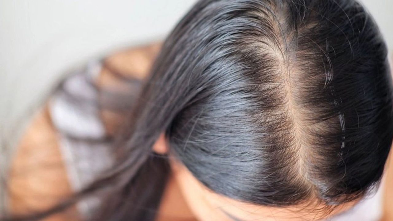 Saç Dökülmesini Önlemek İçin Doğal Yağlar: Tatlı Badem Yağı