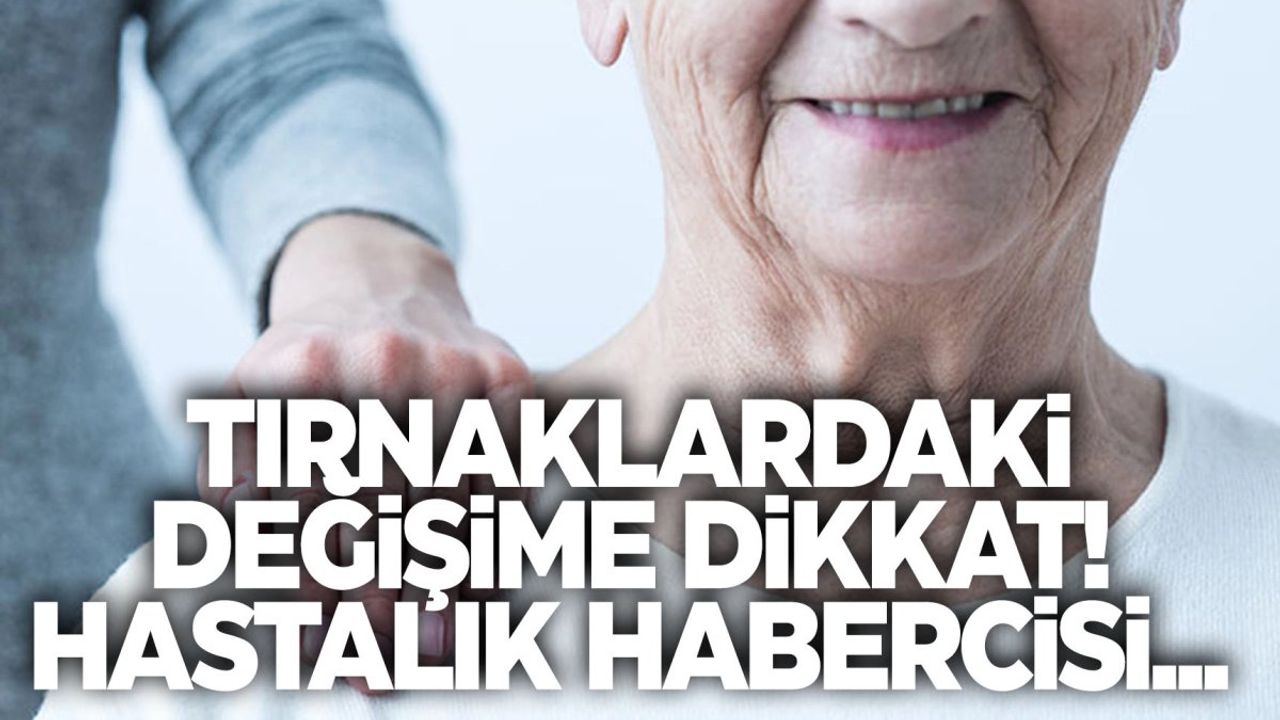 Tırnaklardaki Değişimler Demansın İlk Belirtileri Olabilir