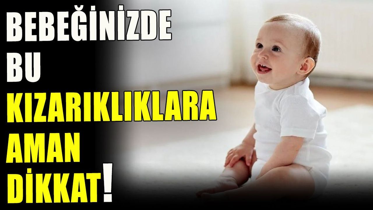 Sıcak Havalarda Bebeklerde Görülen Pişik ve İsilik Sorunlarına Dikkat