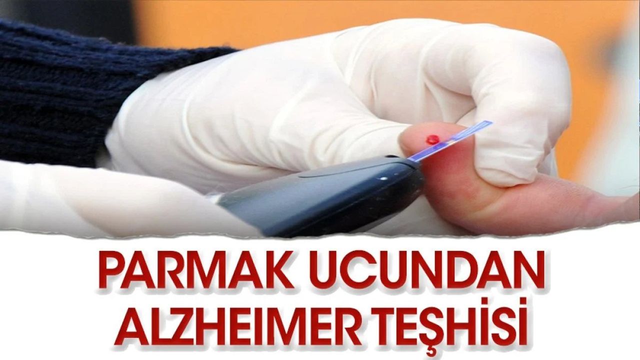 Parmak Ucundan Alzheimer Teşhisi