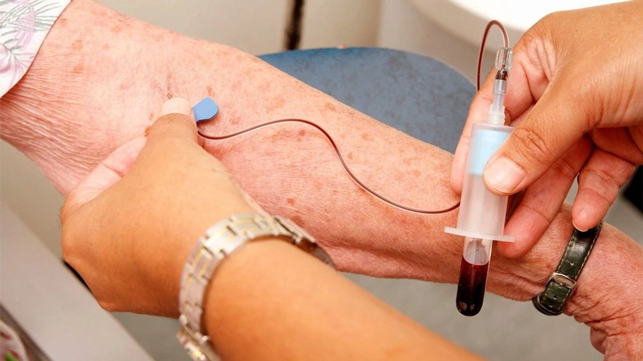 Alzheimer Hastalığının Erken Teşhisi İçin Kan Testleri Önemli Bir Adım Olabilir