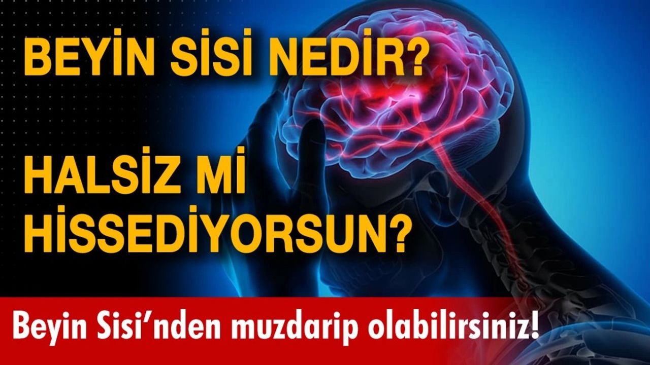 Beyin Sisi Nedir? Belirtileri Nelerdir?