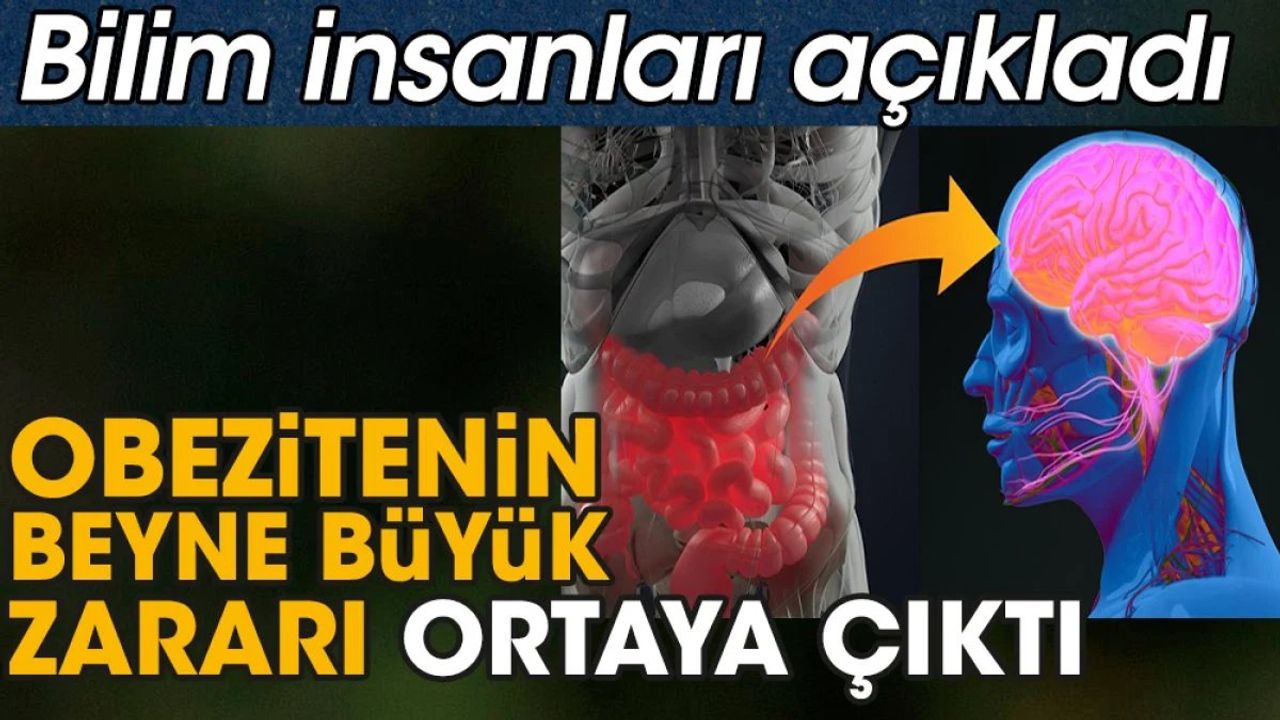 Obezitenin Beyne Etkisi: Hipotalamusun Daha Büyük Olması