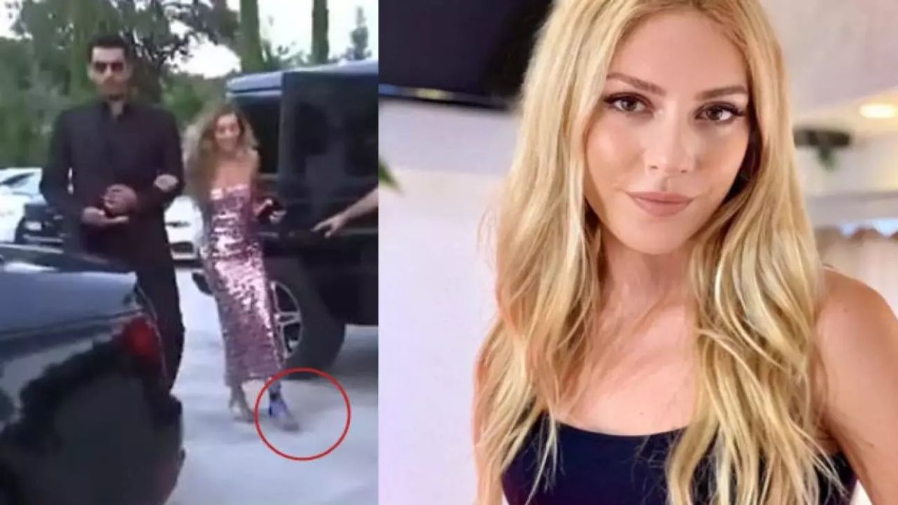 Sinem Kobal Evde Talihsiz Bir Kaza Geçirdi