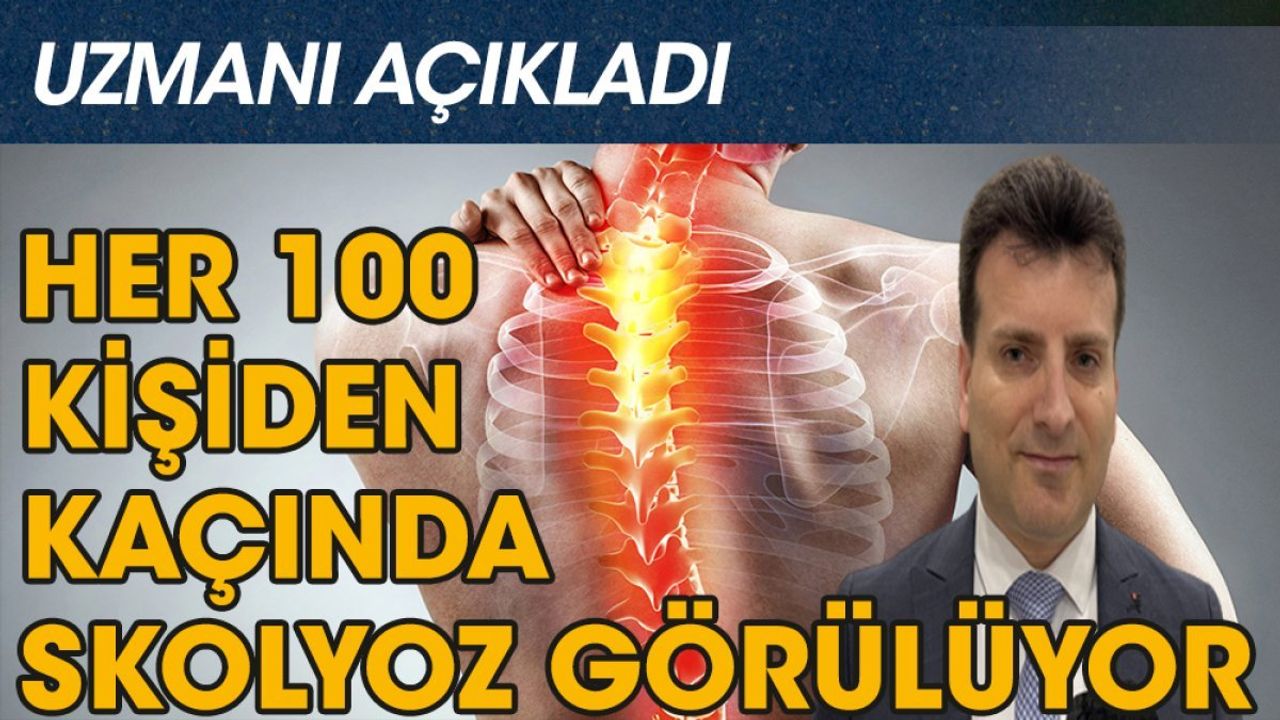 Skolyoza Dikkat! Her 100 Kişiden 3'ünde Skolyoz Görülüyor