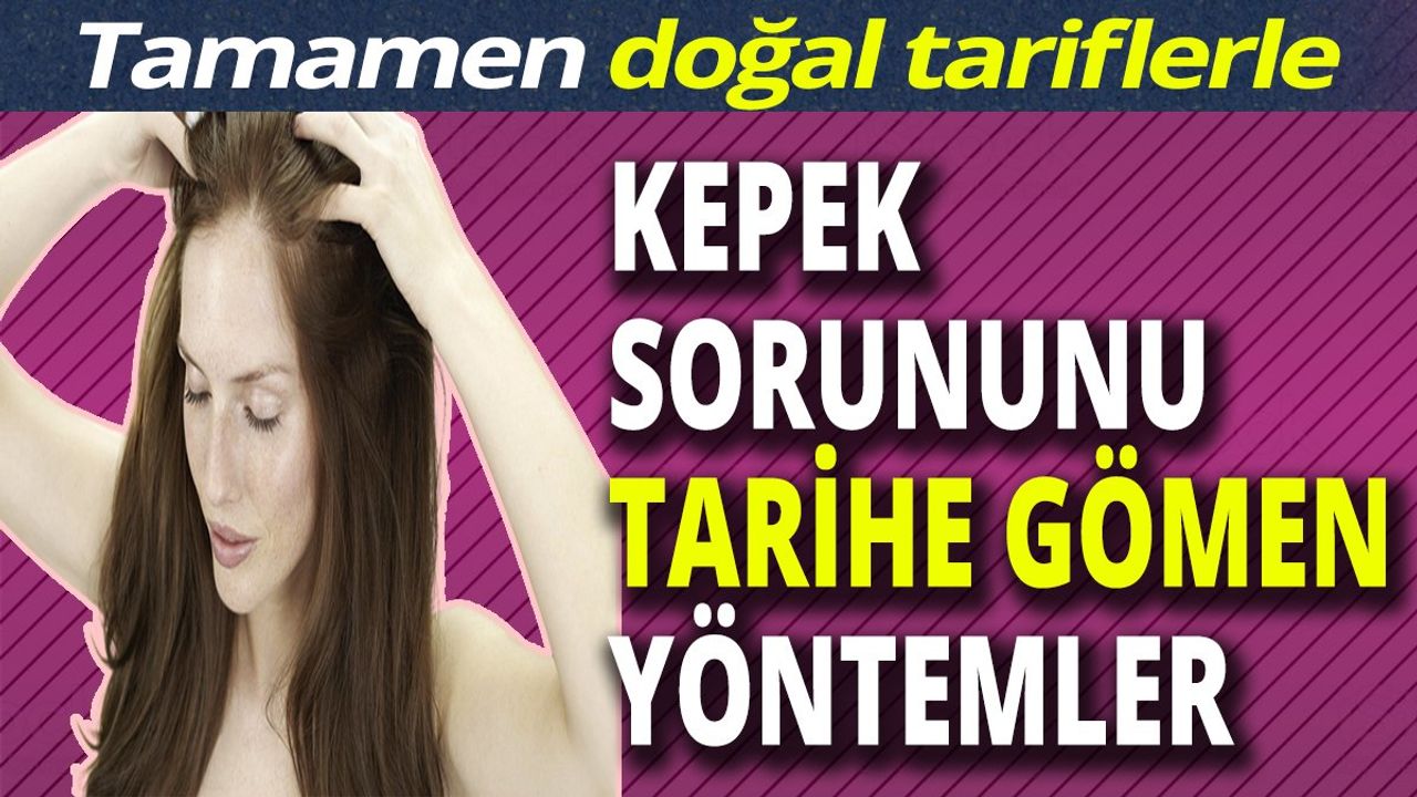 Tamamen doğal tariflerle! Kepek sorununu tarihe gömen yöntemler