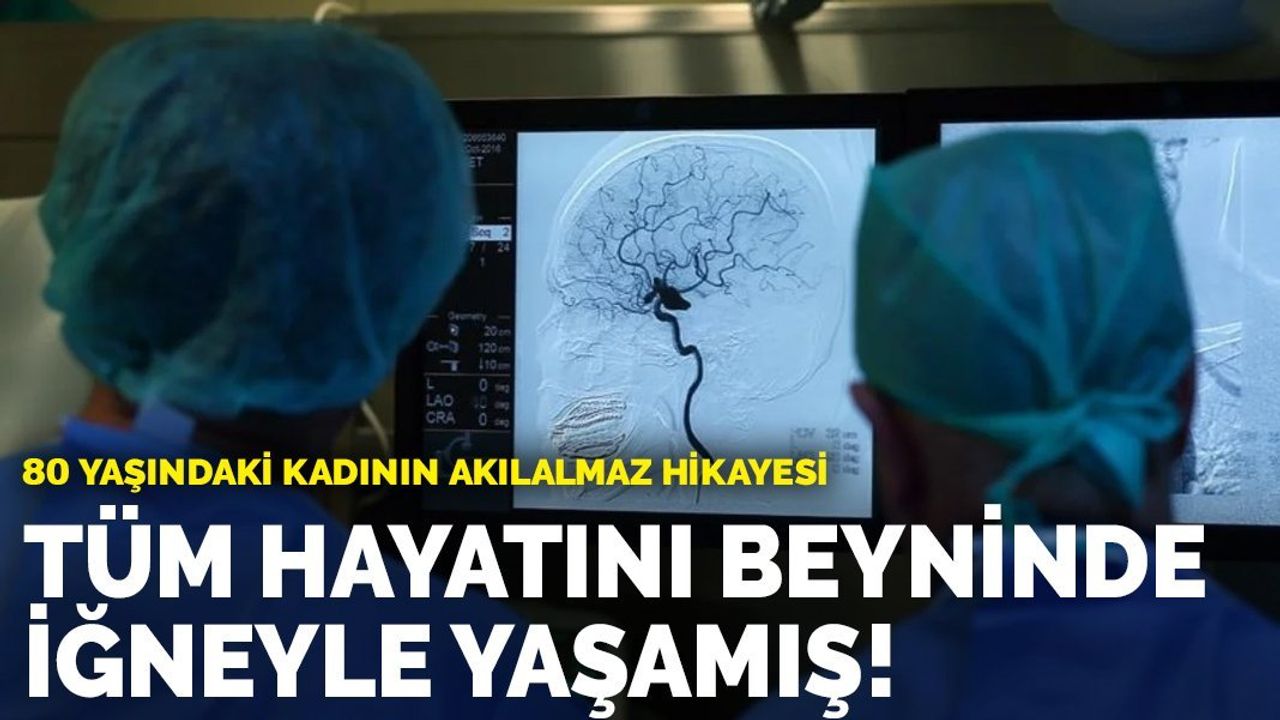 80 Yaşındaki Kadının Akılalmaz Hikayesi: Hayatı Boyunca Beyninde İğneyle Yaşamış!