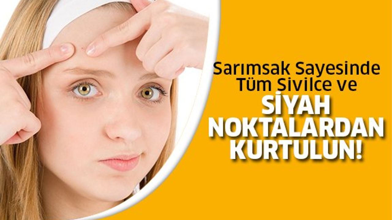 Sivilceler İçin Bitkisel Çözüm: Sarımsak