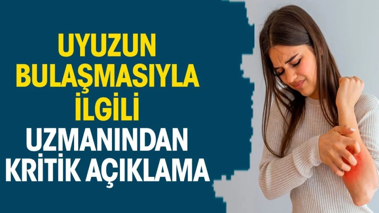 Uyuz Hastalığı ve Uzmanların Açıklamaları