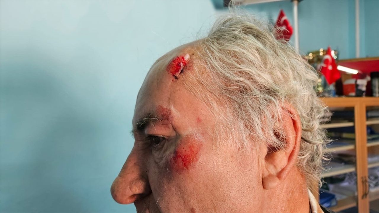 Burdur'da Sahipsiz Köpeklerin Saldırısına Uğrayan Olay
