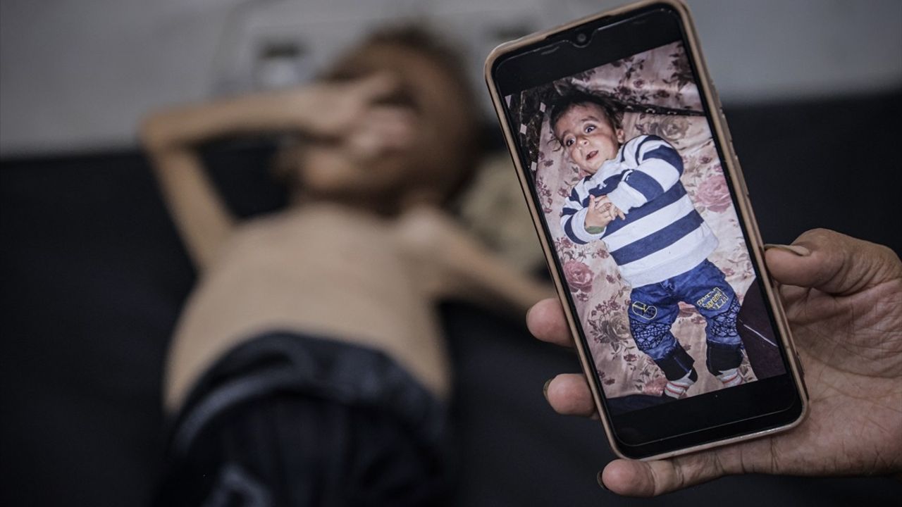 Gazze'deki Şiddetli Açlık: Filistinli Bebek ve Doktorun Açıklamaları