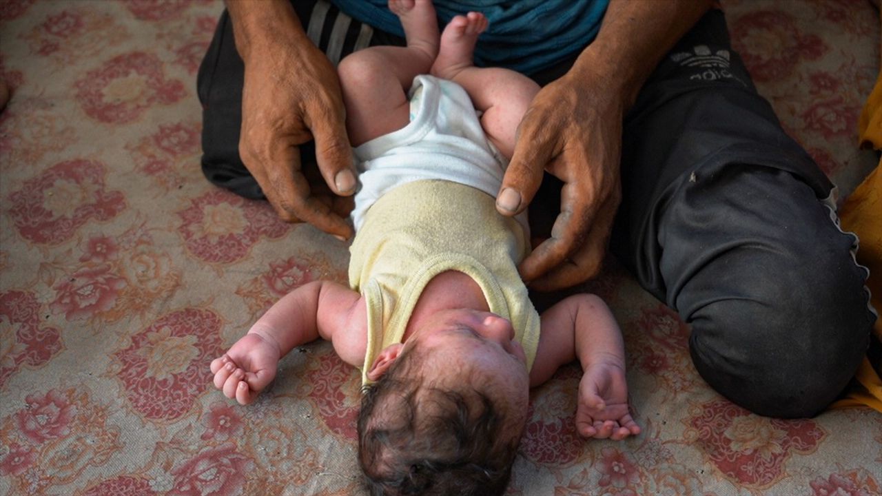 Gazze'de Tekerlekli Sandalyeye Mahkum Bir Baba Hayatta Kalma Mücadelesi Veriyor