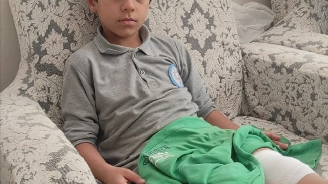 Bursa'da Sahipsiz Köpeğin Saldırısı: Çocuk Yaralandı