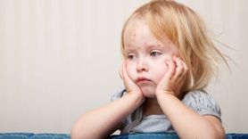 Kızamık Vakalarındaki Artış Uzmanları Endişelendiriyor