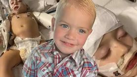 Beyin Yiyen Amip: Naegleria fowleri