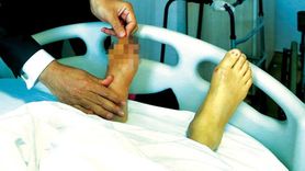 Ayak Kokusu ve Şeker Hastalığı İlişkisi