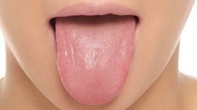 Dil Rengi ve Hastalık Belirtileri