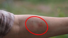 Tek Isırığı Komaya Sokuyor! Sürü Sürü Saldırıya Geçtiler!