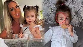 Nadir Görülen Göz Kanseri Retinoblastoma Nedir?