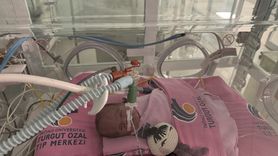 Ağrı'da Erken Dünyaya Gelen Ayaz Bebeğin Tedavisi Sürüyor