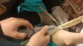 Sivas'ta Demir Parmaklık Saplanan Çocuk Kurtarıldı