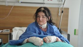 Amerikalı Genç Kız, Eskişehir'de Hayat Değiştiren Ameliyat Geçirdi