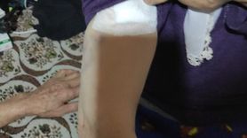 Burdur'da Sahipsiz Köpeklerin Saldırdığı Kadın Yaralandı