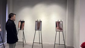 Yapay Zeka ile Romatizmal Hastalıkların Görselleştirilmesi