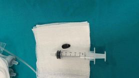 Batman'da 15 Aylık Bebek Başarılı Ameliyatla Hayata Döndü