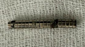 Elazığ'da 3 Yaşındaki Çocuğun Yemek Borusundaki 19 Mıknatıs Başarıyla Çıkarıldı