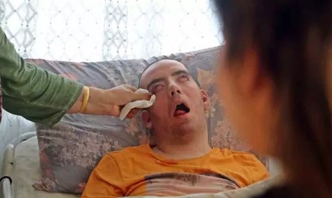 Antalya'da Bir Genç, Gözlerini Kırpamadan Ölümle Savaşıyor