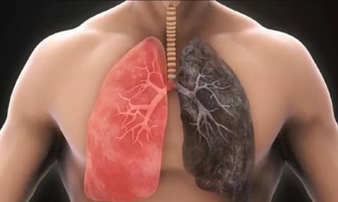 Akciğerleri Temizleyen Doğal Kür Tarifi