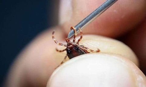 Sivas'ta Kene Yüzünden Hayatını Kaybeden Cemil Gürbüz