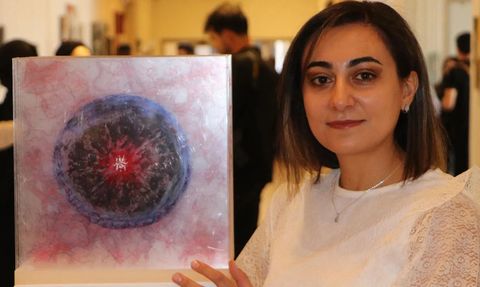 Migren Hastalığı Sanata Yansıtıldı