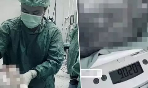 Tayland'da 9 Kilogramlık Dev Kist Ameliyatı