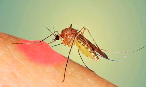 Sinek ve Böcek Isırıklarına Doğal Çözümler