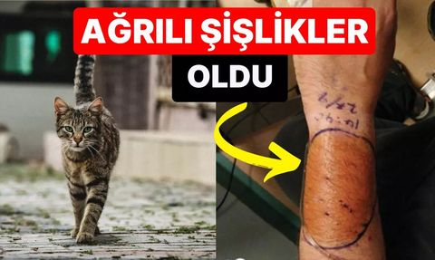 Sokak Kedisi İsırığından Bilinmeyen Enfeksiyon Kapıldı!
