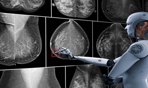 Meme Kanseri Taramasında Yapay Zeka İle Büyük Adım