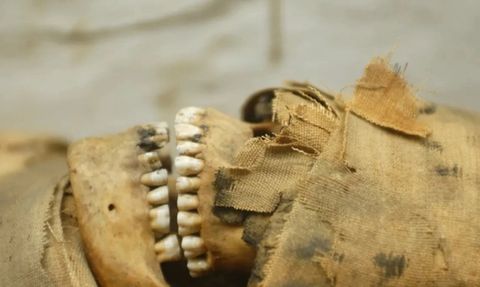 Eski İnsanların Düzgün Dişleri Nasıl Oluyordu?