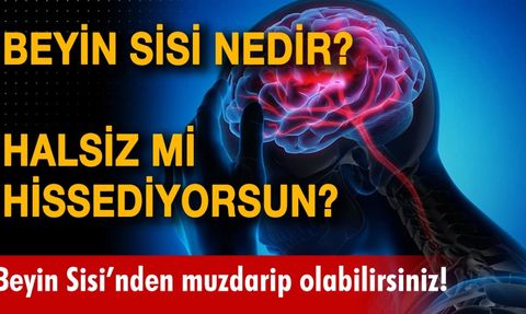Beyin Sisi Nedir? Belirtileri Nelerdir?