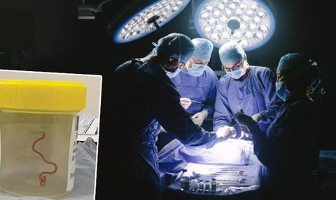 Avustralya'da Bir Kadının Beyninden Canlı Bir Solucan Çıkarıldı