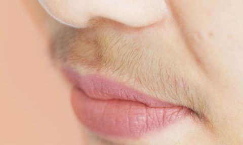 Dudak Üstü Tüylerden Doğal Olarak Nasıl Kurtulabilirsiniz?