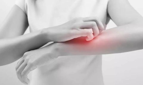 Pandemi vatandaşı 'uyuz' etti: Vakalar yüzde 50 arttı