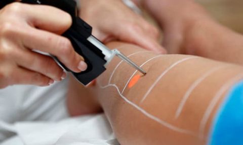 Epilasyoncu Ünlü Şarkıcının Kızlarını Yaktı