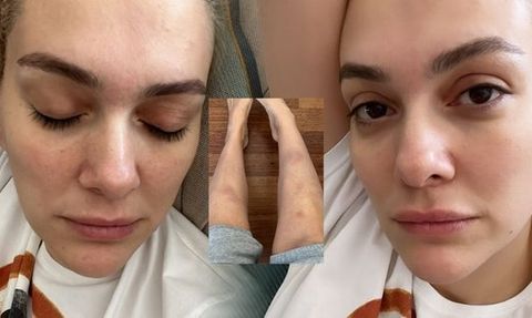 Bergüzar Korel, 'Düğüm' Setinde Yorgunluğunu Paylaştı