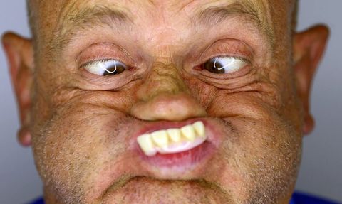 Dünya Bozuk Yüz Şampiyonası