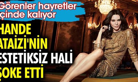 Hande Ataizi'nin Estetiksiz Hali Şoke Etti!
