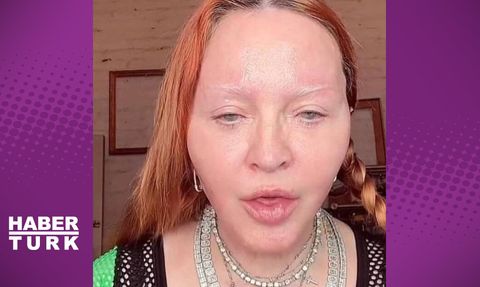 Madonna'nın Filtresiz Videosu Hayranlarını Endişelendirdi