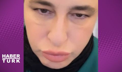 Oyuncu Esra Dermancıoğlu Zona Hastalığına Yakalandı