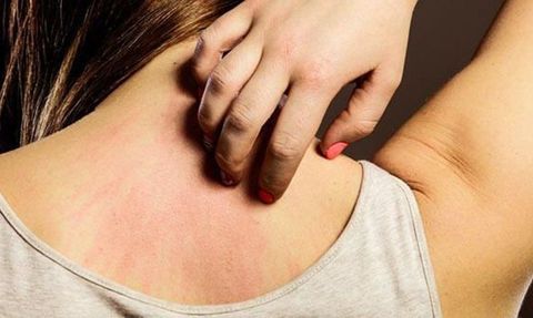 Evde Kaşıntıyı Geçirmek İçin Bitkisel Yöntemler